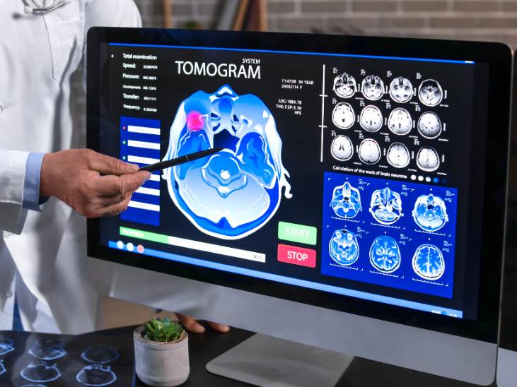 Neurologist